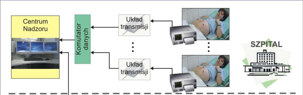 System centralnego monitorowania Klasyczne monitorowanie - pacjentki znajdują się w szpitalu, aparaty monitorujące (kardiodiotokografy)
