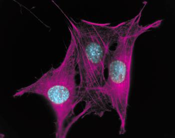 Promieniowanie powoduje uszkodzenia DNA Cytoplazma Jądro komórkowe chromosom Ciało