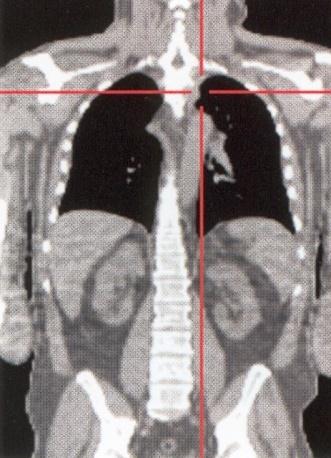 Radiofarmaceutyki Nowoczesnośd w diagnostyce obrazowej CT