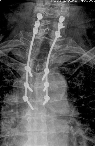 Stabilizacja