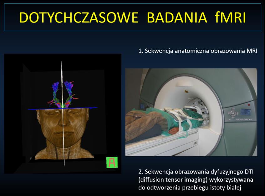 Ryc. 1. Nagroda Nobla dla prof.