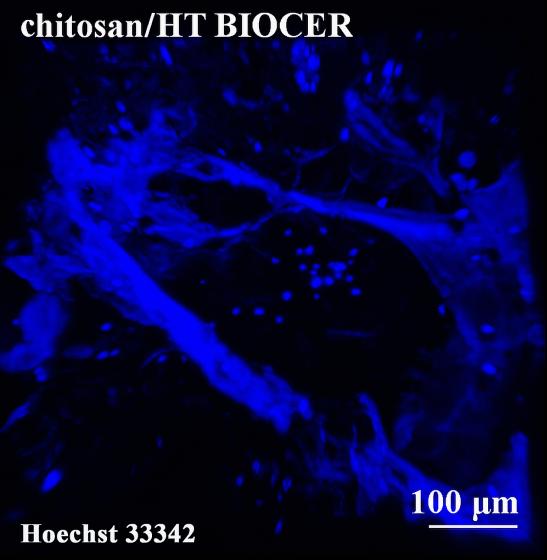 chitosan/ha BIOCER bardziej sprzyja wzrostowi osteoblastów niż powierzchnia kompozytu chitosan/ht BIOCER.