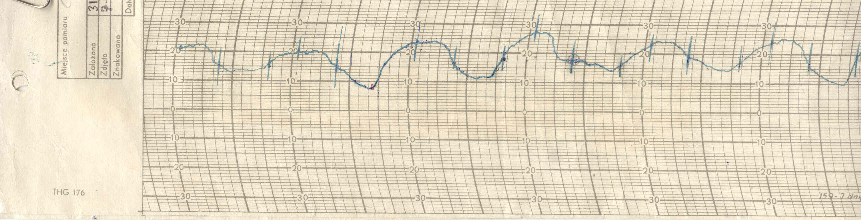 Opracowanie termogramu Termogram pasek papieru z wykresem przebiegu temperatury Linie poziome (proste) skala wartości co 1oC Linie pionowe (łuki) skala czasowa, na