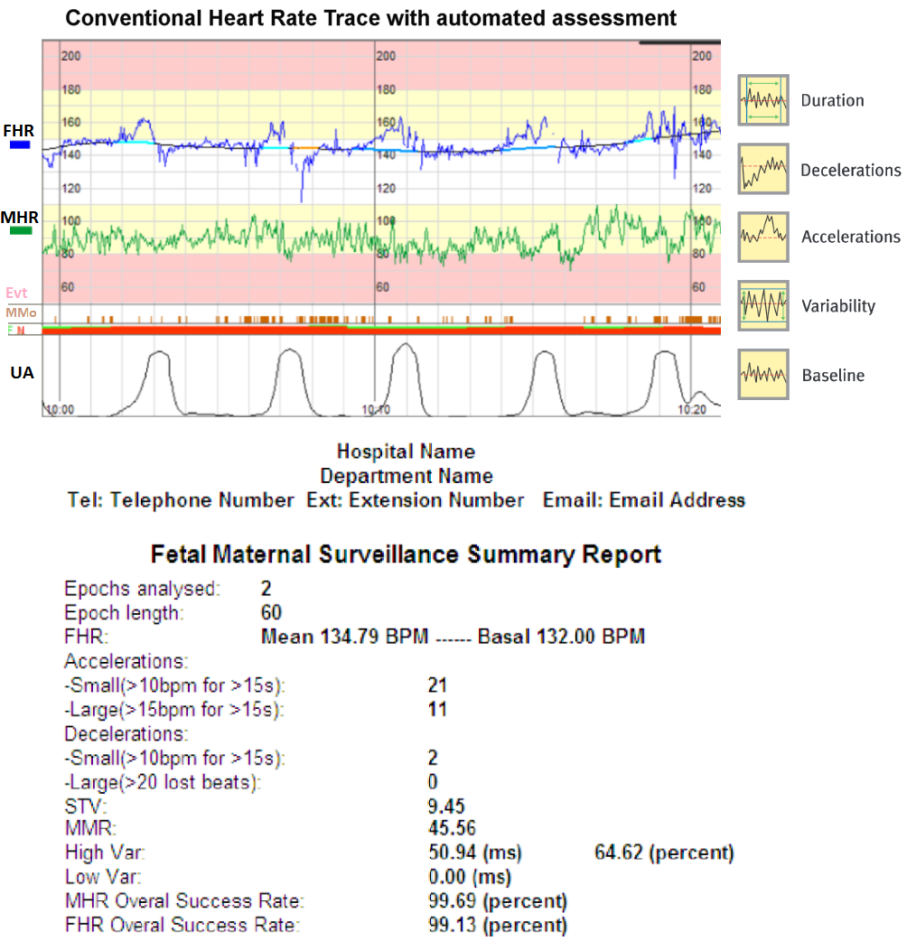 WYNIKI - MONICA DK Elektrokardiografia płodowa (ECG), Częstotliwość bicia serca płodu (FHR), Częstotliwość bicia serca matki (MHR), Elektrohisterogram mięśniówki macicy (EHG), Wykrywa arrytmię,