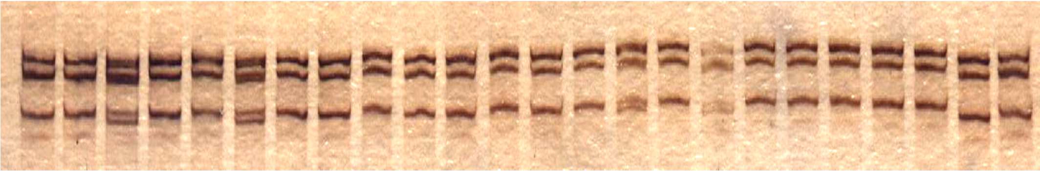 Discovery of a novel SNP at TGFA Mostowska A. et al., Dept. of Biochem. and Molec.