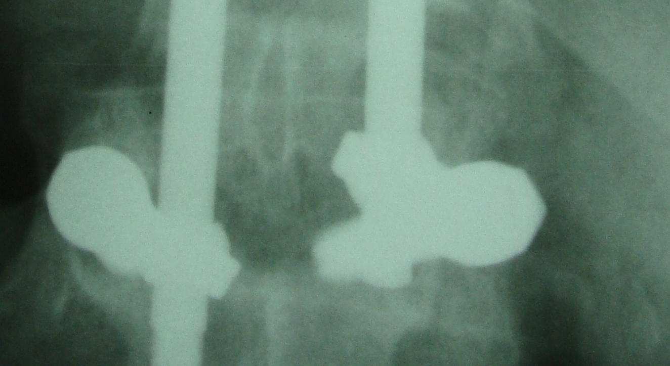 A B C D Ryc. 7.27. Chory M. J.