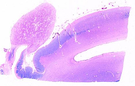 Szyszynka (epiphysis, pineal gland) narząd okołokomorowy, u człowieka wielkości ziarna grochu i