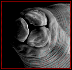 Glista ludzka (askarioza) Glista ludzka - najczęstsza robaczyca przewodu pokarmowego ok.