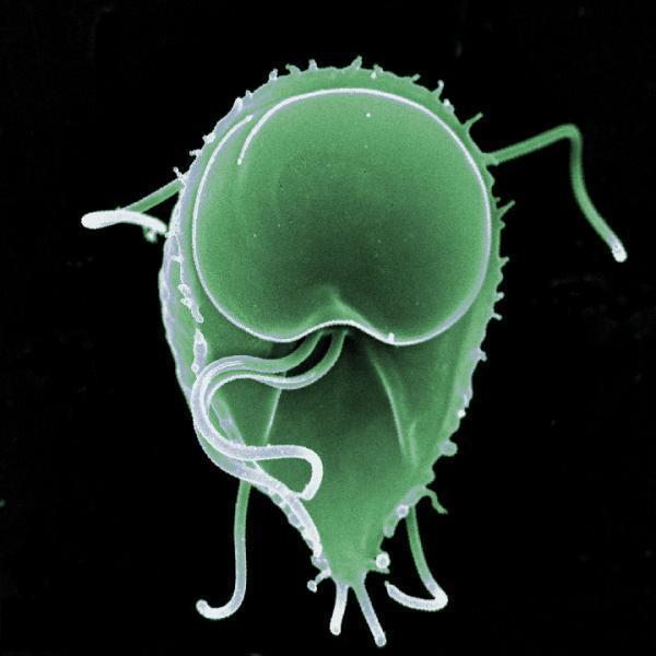 Lamblia (Giardia duodenalis) Lamblia to pierwotniak, zamieszkuje dwunastnicę i drogi żółciowe. Obecność lamblii powoduje problemy trawienne, alergie, brak składników odżywczych.