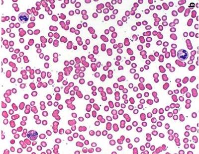 Krew Barwienie: May-Grünwald-Giemsa Objętość krwi u dorosłego człowieka około 7% masy ciała.