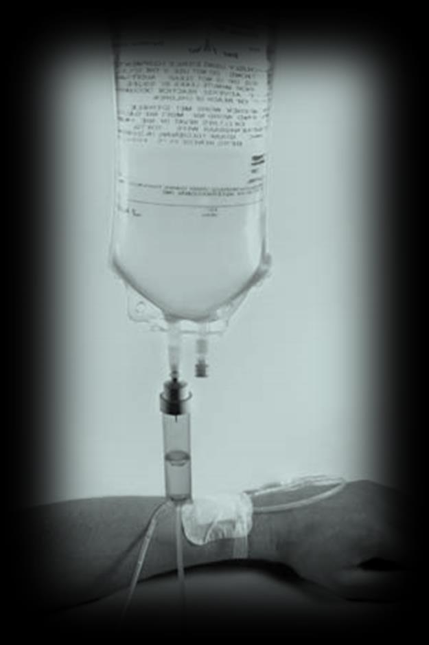 HIPONATREMIA: ODWODNIENIE
