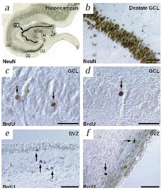 NEUROGENEZA jako przejaw plastyczności ośrodkowej Peter S.