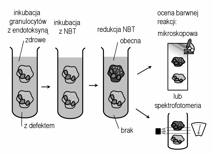 Test pochłaniania NBT Przewlekła choroba