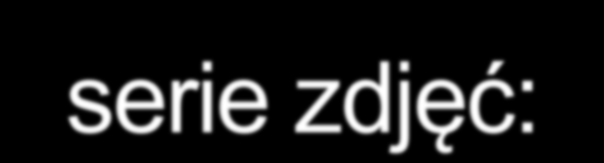 Powinno wykonać się następujące serie zdjęć: A.