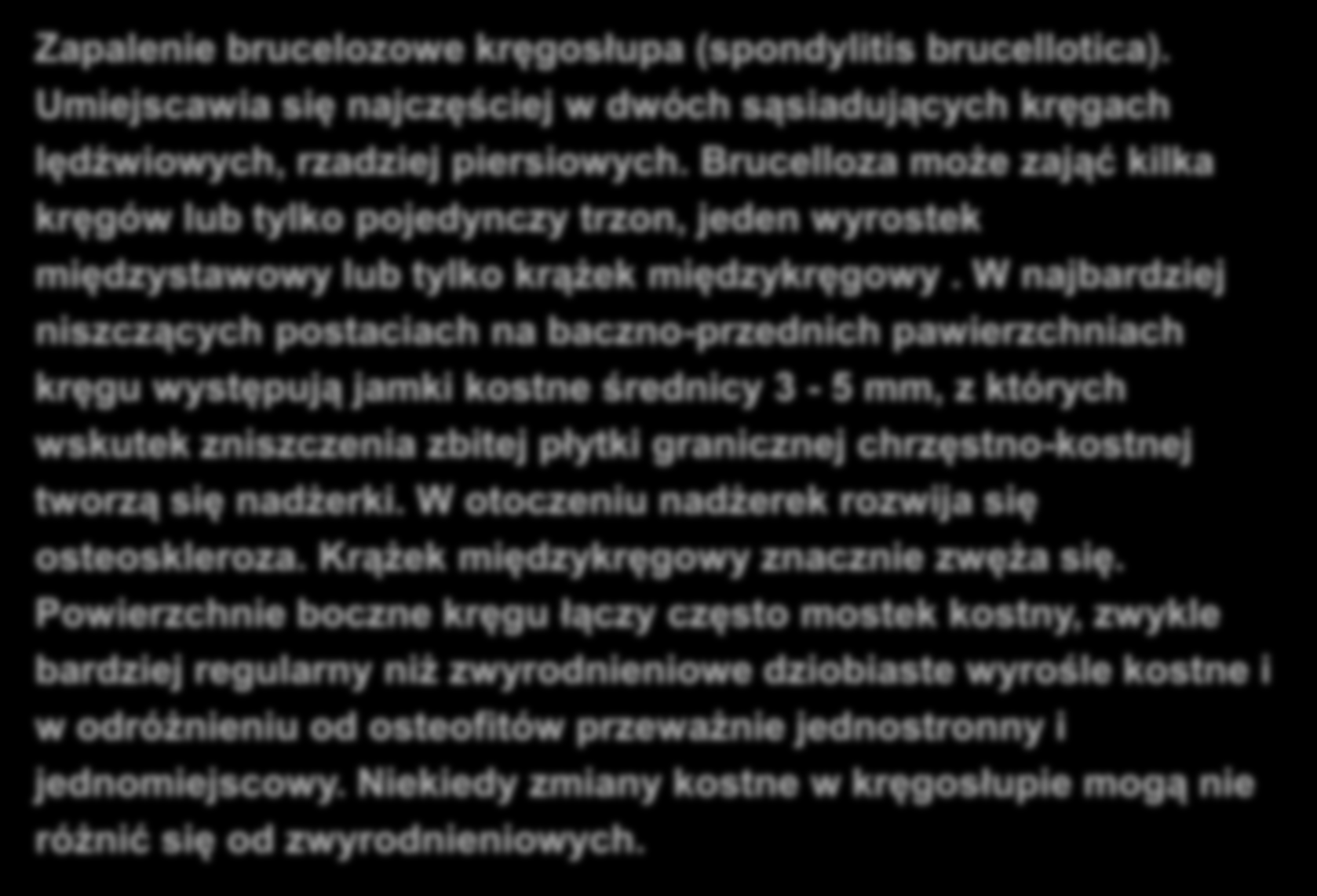 BRUCELOZA NARZĄDU RUCHU Zapalenie brucelozowe kręgosłupa (spondylitis brucellotica). Umiejscawia się najczęściej w dwóch sąsiadujących kręgach lędźwiowych, rzadziej piersiowych.