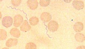 Borrelia burgdorferi sensu lato Genogatunki: B.