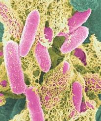 http://upload.wikimedia.org/wikipedia/commons/6/69/e-coli-in-color.