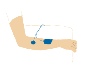 - 9 - Protokoły zabiegowe EMS Opracowane przez BioMedical Life Systems Złamanie typu Colles a, Wyprost nadgarstka 20-60 Hz 4 sek. 10 sek.