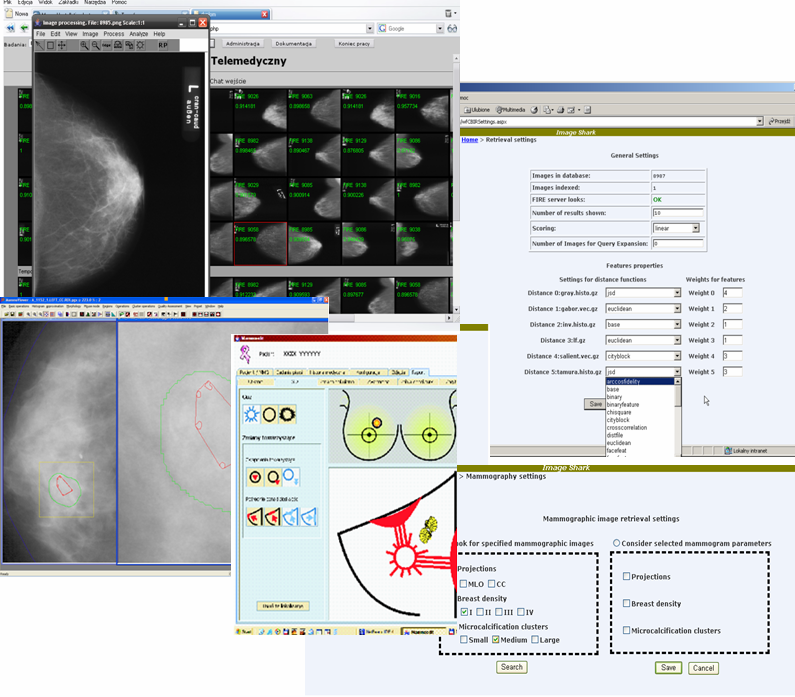 3.8. ROZSZERZENIE OBSZARU ZASTOSOWAŃ radiolog może korzystać z modułów do oglądania badań z zaawansowanymi metodami poprawy percepcji obrazów i z sugestiami potencjalnych patologii oraz modułu do