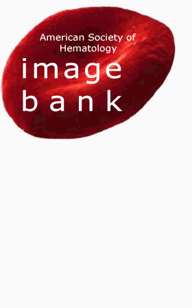 ASH Image Bank 2002;2002:100514 Copyright