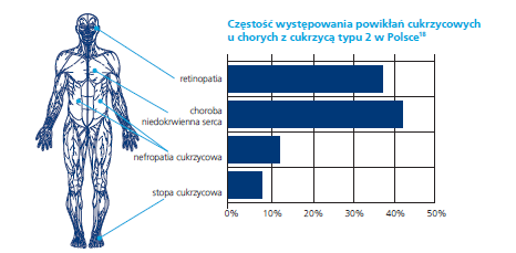Cukrzyca w Polsce Najczęstsza przyczyna schyłkowej niewydolności nerek wśród chorych wymagających dializowania. Na stałe 3 tys. chorych jest dializowanych Rocznie 14 tys. amputacji kończyn dolnych.