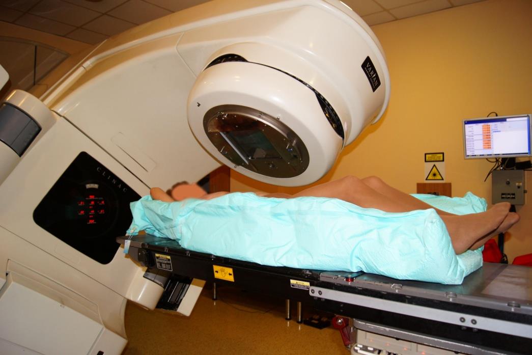 Radioterapia