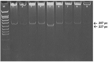 ANNALES ACADEMIAE MEDICAE SILESIENSIS 2013, 67, 3 W celu uzyskania odpowiedniej puli zrekombinowanych plazmidów wprowadzono je do komórek prokariotycznych Escherichia coli szczepu DH5α, w których