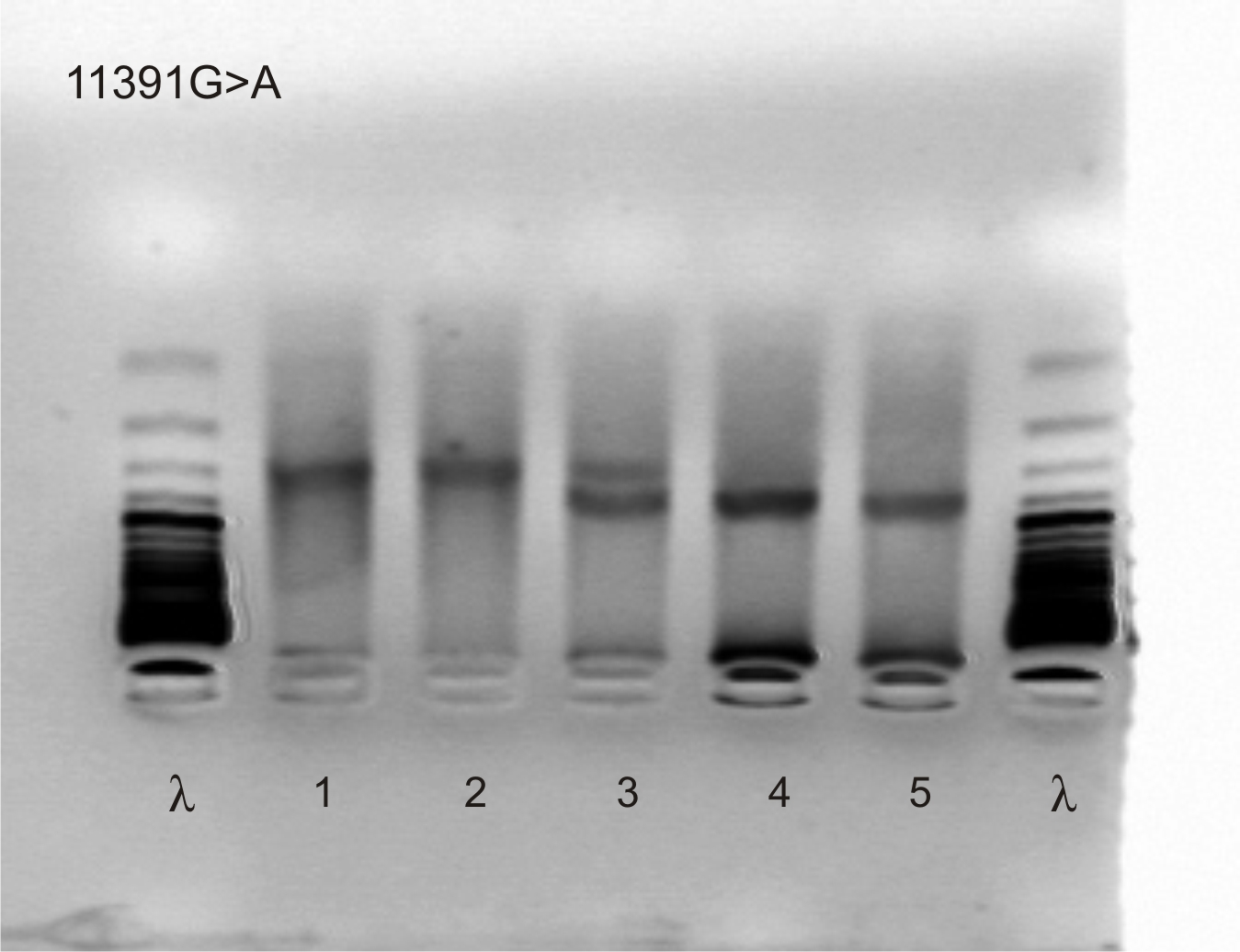 Metody Osoby badane: 11 chorych z zespołem metabolicznym wg ATP III Zakład Biochemii Klinicznej UJCM 55 chorych z cukrzycą typu 2 (DM2) i 494 osoby grupy kontrolnej () Katedra i Klinika