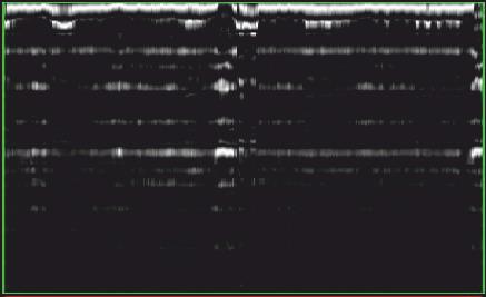Technika georadarowa (GPR)