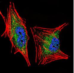 Immunohistochemia c.d.