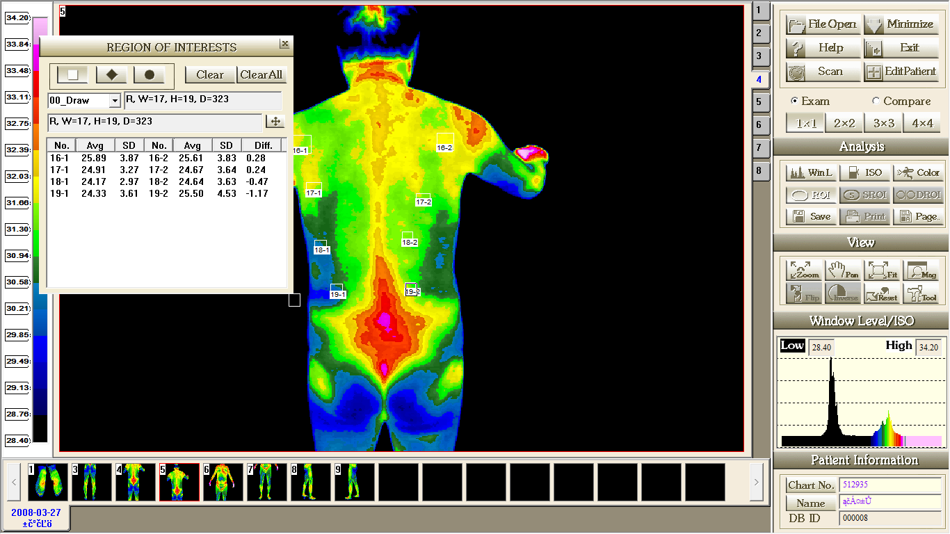 Ekran Główny Narzędzia do analizy obrazu Win L ustalanie zakresu temperatur do analizy konkretnego obrazu (aktywuje okno Window Level/ISO gdzie ręcznie ustalamy zakresy temperatury do analizy) ISO