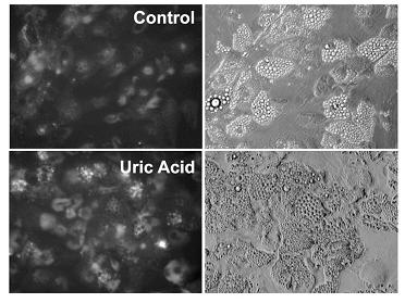 Kwas moczowy jako pro-oksydant - Inkubacja adipocytów in vitro w obecności kwasu moczowego prowadzi do indukcji