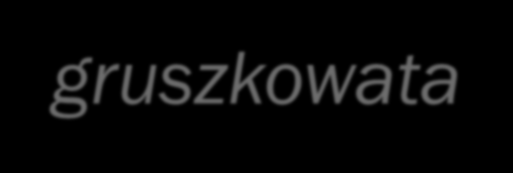 Klatka piersiowa szewska, lejkowata Klatka piersiowa gruszkowata w dolnej części wgłobienie, może być zmianą wrodzoną lub na skutek zmian krzywiczych zwykle bezobjawowa jeśli