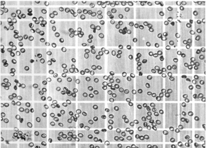 W klasycznym ujęciu do podstawowych parametrów hematologicznych zaliczamy: koncentrację krwinek czerwonych (RBC), stężenie hemoglobiny (HGB), hematokryt (HCT), koncentrację krwinek białych (WBC).