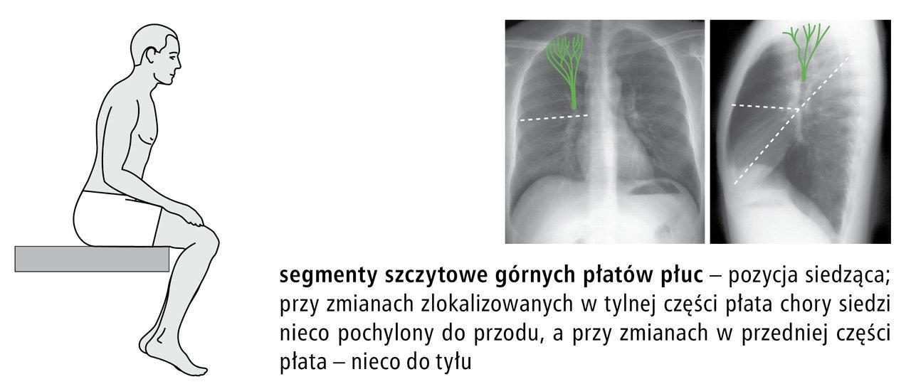 Segmenty szczytowe płaty górne