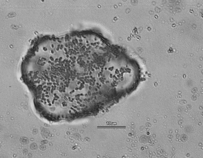 Bioremediacja Bioremediacja to proces oczyszczania, w którym wykorzystywane są mikroorganizmy (bakterie, grzyby) Przeprowadzają one rozkład substancji niebezpiecznych do mniej toksycznych lub