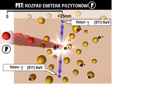 Rys. 2. Anihilacja pozytonu i elektronu. Pacjent od momentu podania mu roztworu zawierającego promieniotwórczy izotop 18F staje się źródłem promieniowania gamma.