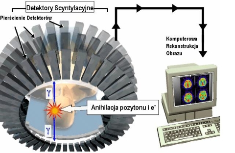 Rys. 3. Schemat detekcji aktów anihilacji w tomografie PET.