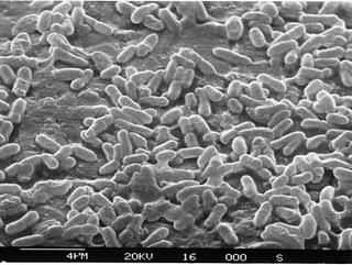 Listeria monocytogeneszagrożenie bezpieczeństwa żywności