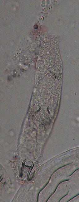 Dactylogyrus spp. Dactylogyrozę wywołują jajorodne przywry Dactylogyrus spp. W budowie wyróżnić można cztery plamki świetlne w okolicy otworu gębowego.