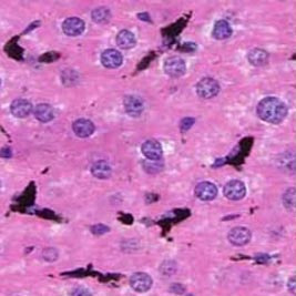 długich Makrofagi śledziony Komórki Kupfera Układ siateczkowośródbłonkowy