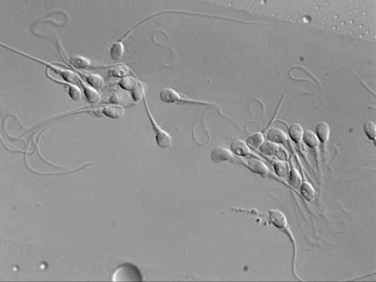 (hyaluronic acid binding), ultramorflogia (high magnification).