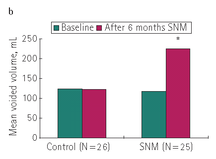 Przegląd systematyczny vs doświadczenia 1 ośrodka (10 lat) 67% pacjentów osiąga więcej niż 50% zmniejszenie epizodów nietrzymania moczu 39% osiąga całkowitą kontrolę nad oddawaniem