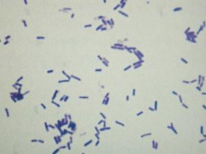 BAKTERIE PRZETRWALNIKUJĄCE Bacillus sp.