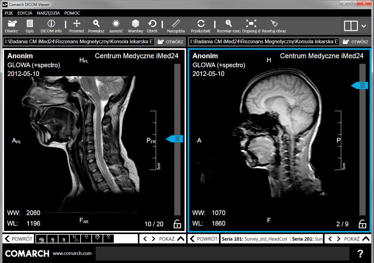 COMARCH DICOM VIEWER - PRZEGLĄDARKA OBRAZÓW MEDYCZNYCH Nowoczesna przeglądarka obrazów medycznych od Comarch.