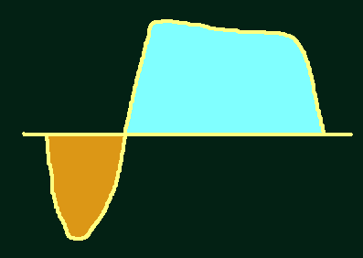 ECHO - DOPLER SPEKTRALNY całka prędkości przepływu w czasie Velocity Time Integral