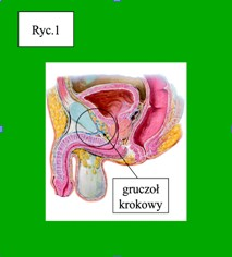 Rak gruczołu krokowego Rak stercza (PCa - prostatic cancer) należy do najczęściej występujących nowotworów złośliwych u mężczyzn.