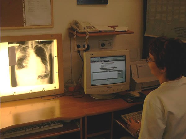 mammografii