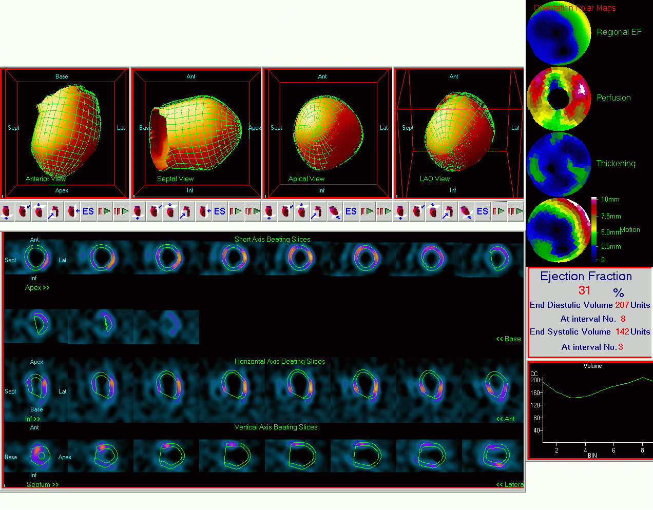 GSPECT - patologia Press key