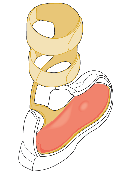 2. Opis produktu Dodatkowa wkładka Dla idealnego dopasowania oraz wsparcia stopy, zalecamy za każdym razem użycie indywidualnej wkładki, którą należy umieścić na podeszwie ortezy WalkOn Reaction!